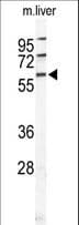 HABP2 Antibody (aa378-408)