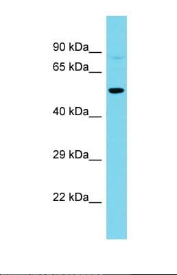 FAK / Focal Adhesion Kinase Antibody (aa198-246)
