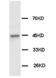 IHC-plus™ Monoclonal Mouse anti-Human KRT18 / CK18 / Cytokeratin 18 Antibody (clone CK-18, IHC, WB)