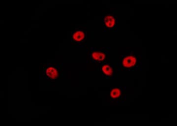 Polyclonal Rabbit anti-Human HIST3H3 Antibody (Methyl-Lys9, IHC, IF, WB)