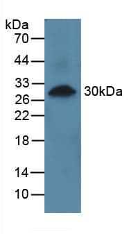 Polyclonal Rabbit anti-Human PRCP Antibody (APC, aa108-376, WB)