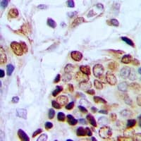 TAF15 Antibody (Internal)