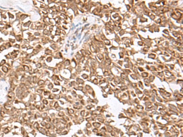 Polyclonal Rabbit anti-Human USP16 Antibody (IHC)