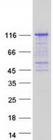 Human C17orf71 Protein (Recombinant Myc-DDK (Flag))