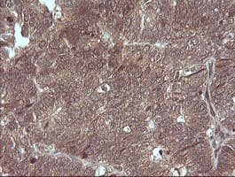 Monoclonal Mouse anti-Human MAP2K3 / MEK3 / MKK3 Antibody (clone OTI1H6, IHC, IF, WB)