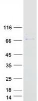 Human CAPN6 / Calpain 6 Protein (Recombinant Myc-DDK (Flag))