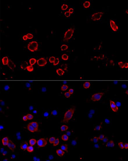 Polyclonal Rabbit anti-Human CD68 Antibody (IF)