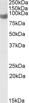 IHC-plus™ Polyclonal Goat anti-Human PLA2G4A Antibody (aa153-166, IHC, IF, WB)