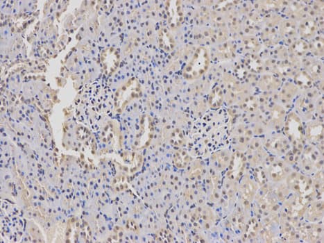 IHC-plus™ WAS / WASP Antibody