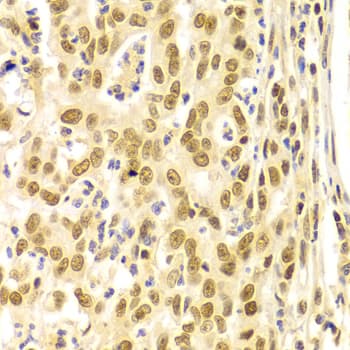 Polyclonal Rabbit anti-Human BMI1 / PCGF4 Antibody (IHC, IF, WB)