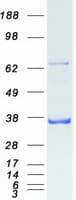 Human PDLIM1 Protein (Recombinant Myc-DDK (Flag))