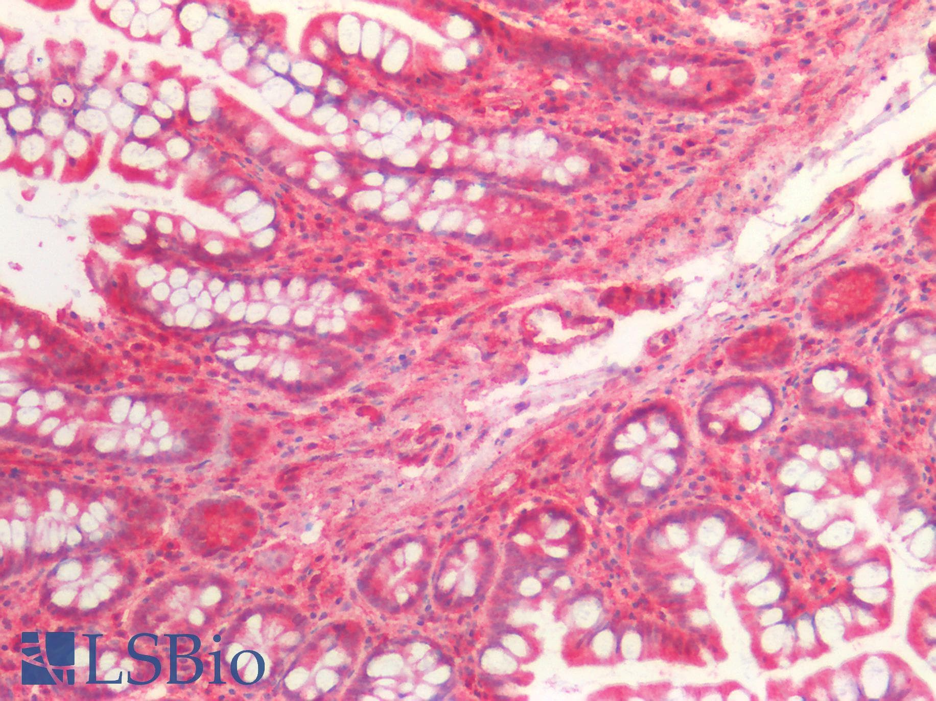 IHC-plus™ BCL2L2 / Bcl-w Antibody (aa2-193)