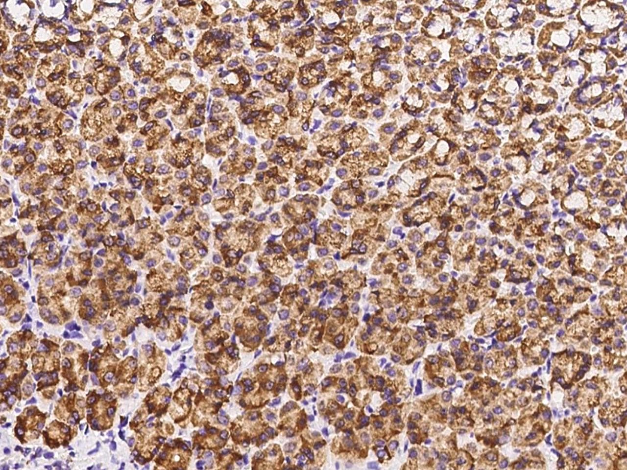 Polyclonal Rabbit anti-Rat CTHRC1 Antibody (Preservative Free, IHC)