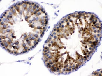 WNK1 Antibody