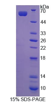 Human SHMT / SHMT2 Protein (Recombinant His)