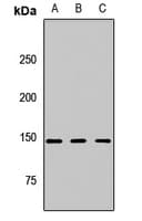 Polyclonal Rabbit anti-Human CSPP1 Antibody (WB)