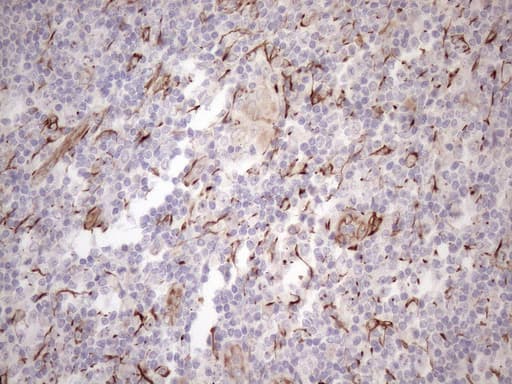 KRT18 / CK18 / Cytokeratin 18 Antibody (aa69-372, clone OTI3D1)