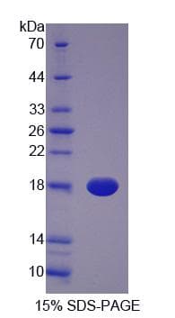 Human BLVRA Protein (Recombinant His-S)