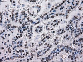 TYRO3 Antibody (clone OTI5B4)