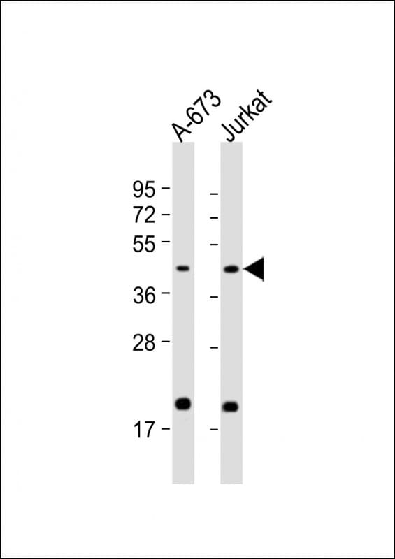 Polyclonal Rabbit anti-Human IL11RA Antibody (aa372-403, WB)