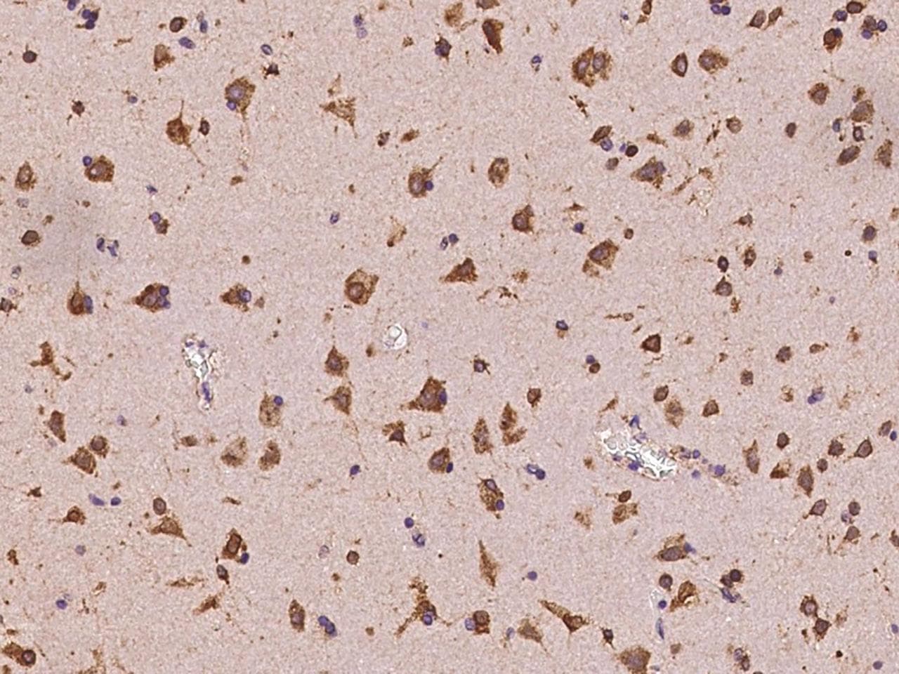 Polyclonal Rabbit anti-Human TANGO / MIA3 Antibody (IHC, IF)