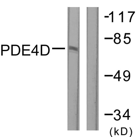 PDE4D Antibody (aa156-205)