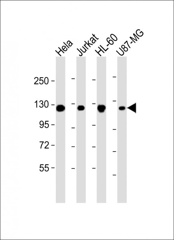 RNF20 Antibody (clone 1594CT552.128.36)