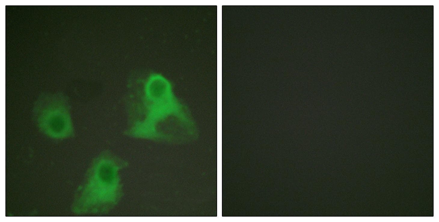 ADD1 / Adducin Alpha Antibody (phospho-Ser726)