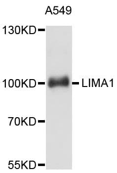 Polyclonal Rabbit anti-Human EPLIN Antibody (WB)