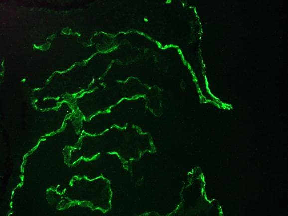 Monoclonal Mouse anti-Human KRT10 / CK10 / Cytokeratin 10 Antibody (clone RKSE60, IHC, WB)