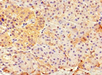 HFM1 Antibody