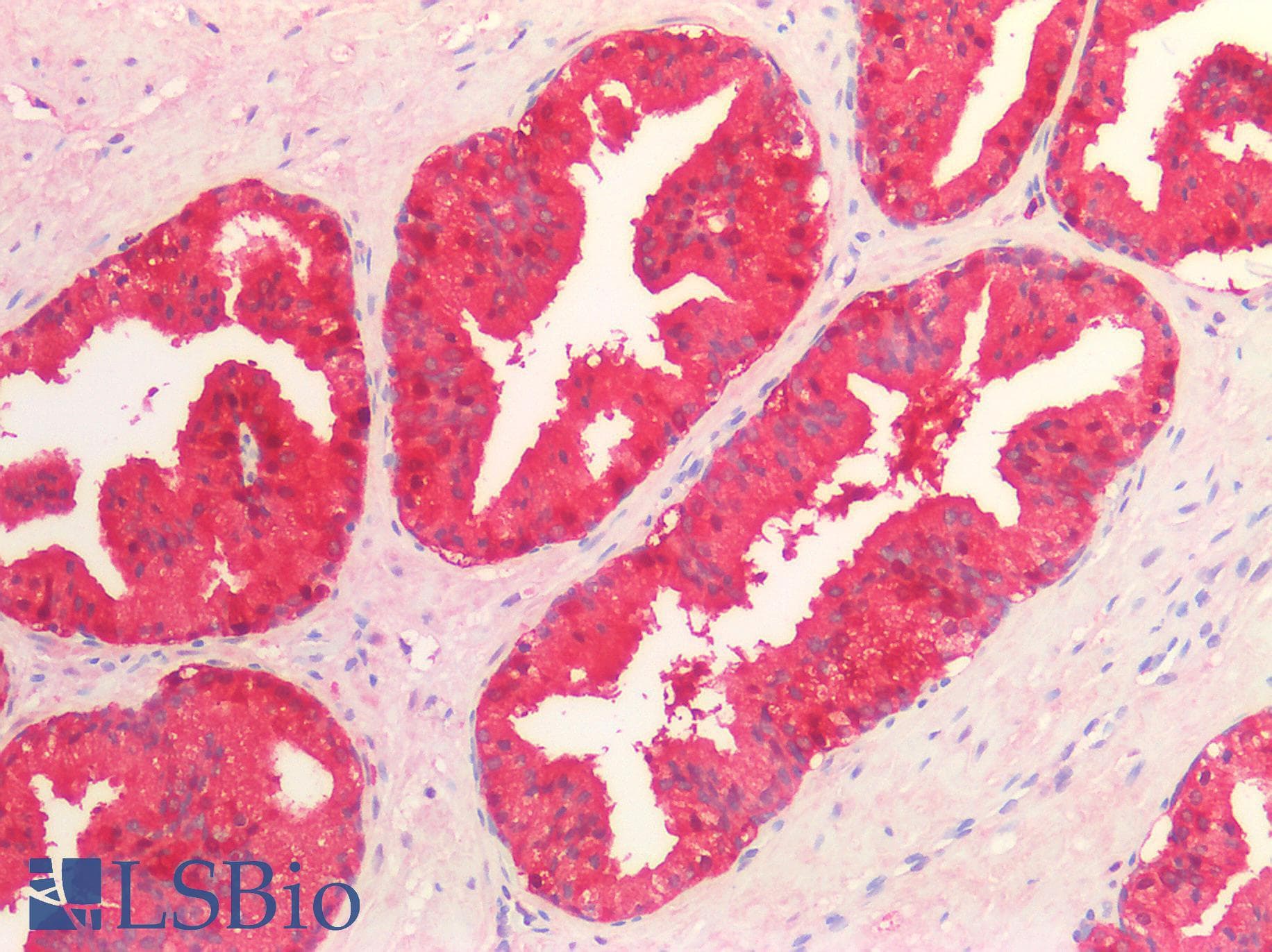 PathPlus™ Monoclonal Mouse anti-Human IDH1 / IDH Antibody (clone C12, IHC, WB)