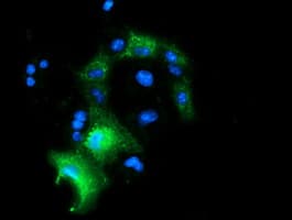 P5CR2 / PYCR2 Antibody (clone OTI5C7)