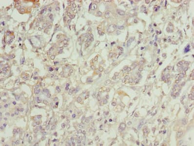 C1orf101 Antibody