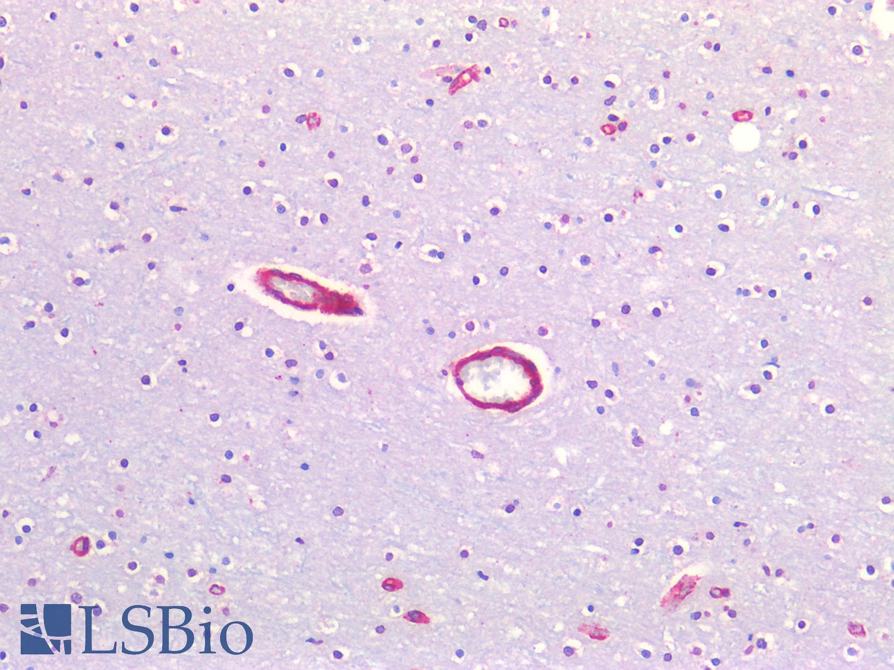 PathPlus™ CAV1 / Caveolin 1 Antibody (N-Terminus)