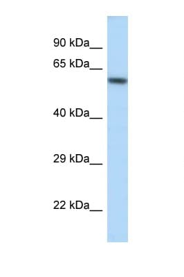 Polyclonal Rabbit anti-Mouse KCNJ3 / GIRK1 Antibody (aa361-410, WB)