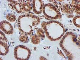 CYB5R3 / B5R Antibody (clone OTI1E8)