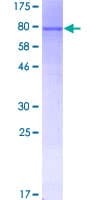 Human ARHGEF5 Protein (Recombinant GST)