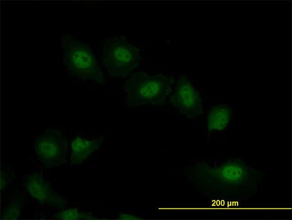 VRK2 Antibody (clone 3B10)