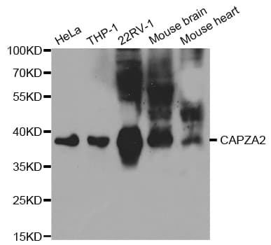 CAPZA2 / CAPZ Alpha 2 Antibody