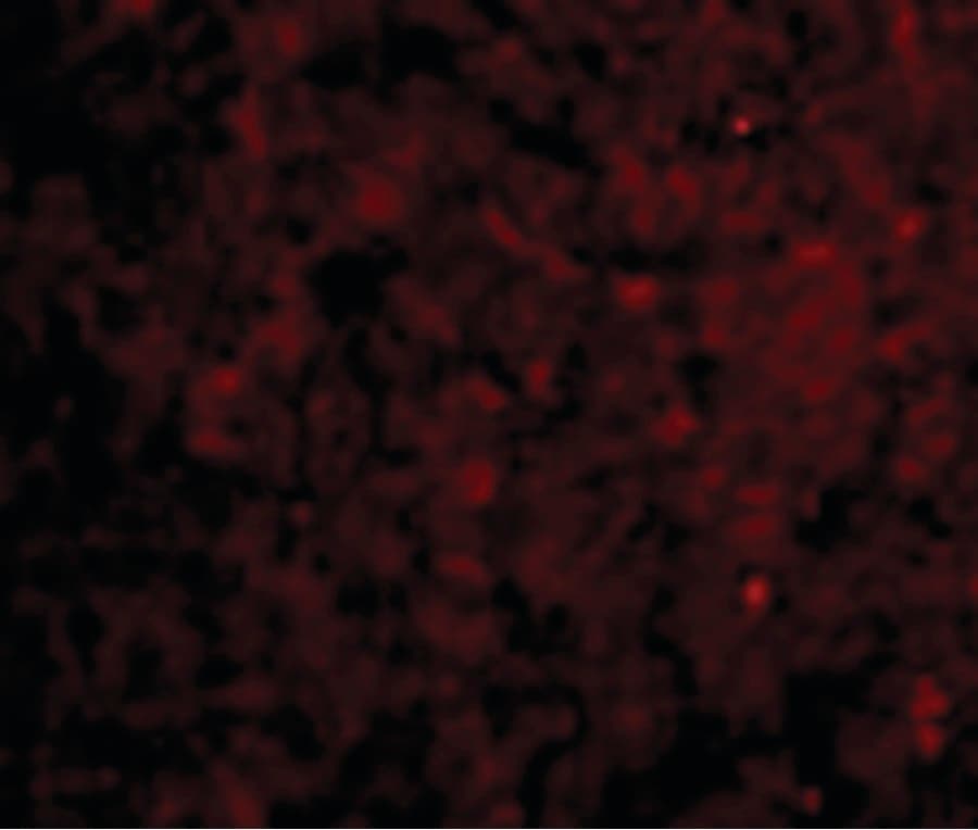 IHC-plus™ Polyclonal Rabbit anti-Human IRAK3 / IRAKM / IRAK-M Antibody (IHC, IF, WB)