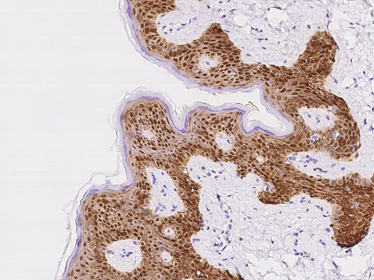 PHGDH Antibody