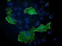 VASP Antibody (clone OTI1C3)