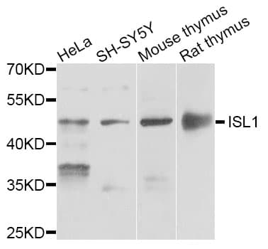 IHC-plus™ Polyclonal Rabbit anti-Human ISLET-1 / ISL1 Antibody (IHC, IF, WB)