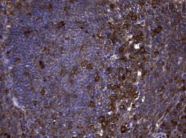 NME1 / NM23 Antibody (clone OTI2A5)