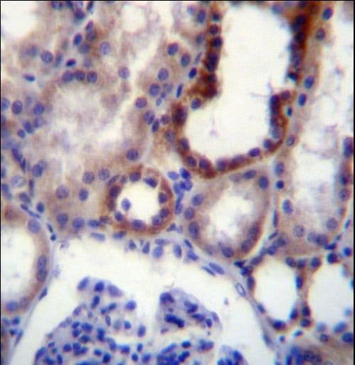Polyclonal Rabbit anti-Human CD316 / IGSF8 Antibody (aa226-254, IHC, WB)