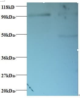 RPS12 / Ribosomal Protein S12 Antibody