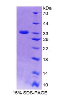 Human LTBP2 Protein (Recombinant His, N-Terminal)