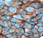 Monoclonal Mouse anti-Human CD99 Antibody (IHC)