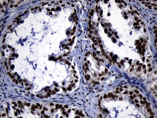 Monoclonal Mouse anti-Human ZHX2 / RAF Antibody (clone OTI2E11, Carrier-free, aa595-837, IHC, WB)